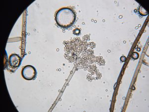 scab sa isang puno ng mansanas sa ilalim ng isang mikroskopyo